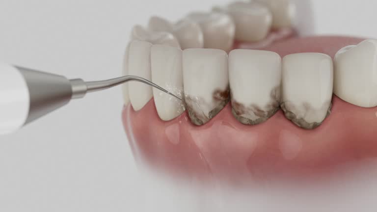 Reliable Dental contractor in Boca Raton, FL by Smile Center Dentistry